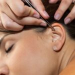 Controla tu ansiedad y alcanza tu peso ideal con auriculoterapia